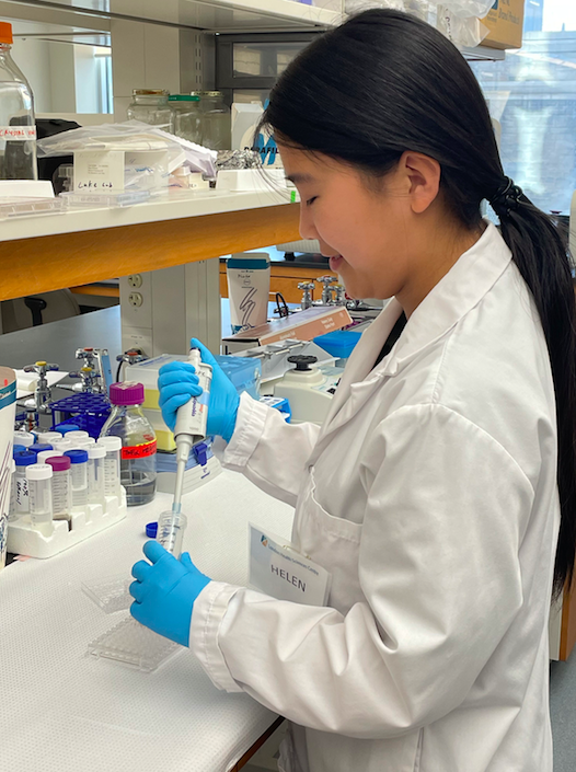 Helen Jin - searching for a drug that will increase the success rate of kidney transplants. (Photo credit: Supplied)